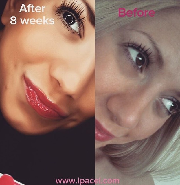 Können Wimpern wachsen ohne eine Wimpernverlängerung?
Die Antwort: Ja! Bereits ab 3 Wochen sieht man die ersten Ergebnisse.
Wie die eigenen Wimpern wachsen und wie das Ipacei Wimpernserum die Wimpern und Augenbrauen länger und fülliger werden lässt, hier:
http://ipacei.com/laengere-wimpern-bekommen/ Können Wimpern wachsen ohne eine Wimpernverlängerung?
Die Antwort: Ja! Bereits ab 3 Wochen sieht man die ersten Ergebnisse.
Wie die eigenen Wimpern wachsen und wie das Ipacei Wimpernserum die Wimpern und Augenbrauen länger und fülliger werden lässt, hier:
http://ipacei.com/laengere-wimpern-bekommen/