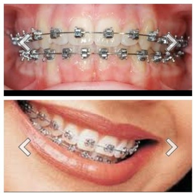 welche ? untere dauert ein halbes Jahr länger unbedingt kommentieren welche ? untere dauert ein halbes Jahr länger unbedingt kommentieren