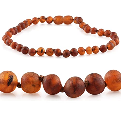 Amber Seven Premium Bernsteinkette | Rohbernsteinkette | 13 Farben | 3 Größen | Höchste Qualität | Baltischer Bernstein | Choker Halskette | Bernsteinschmuck (38 cm, Raw Cognac) von Amber Seven