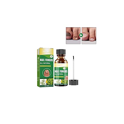 Fun_gal Nail Renewal 30ML,Best Nail Repair Set,Extra Strength Toenail Fun_gus Nail Treatment,Nail Repair Liquid,Fix & Renew Damage Fun_gal Nail,Broken,Cracked&Discolored Nails (1pcs) von Anshka