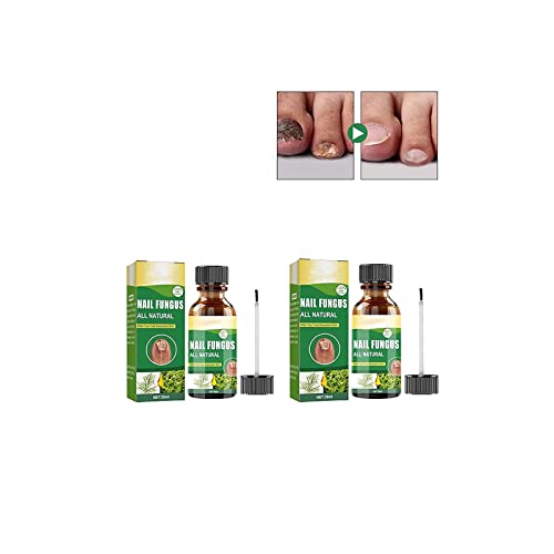 Fun_gal Nail Renewal 30ML,Best Nail Repair Set,Extra Strength Toenail Fun_gus Nail Treatment,Nail Repair Liquid,Fix & Renew Damage Fun_gal Nail,Broken,Cracked&Discolored Nails (2pcs) von Anshka