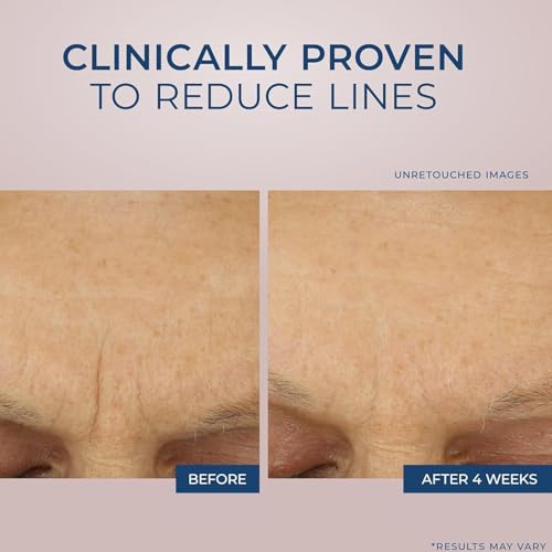 Retinol Anti Falten Feuchtigkeitspflege 48g, Hyaluronsäure Gesichtscreme, Retinol Creme,Gesichtscreme Damen,Antiaging Creme,Gegen Falten,Feuchtigkeitsspendend Und Aufhellend,Sofort Straffend. von Auirshiky