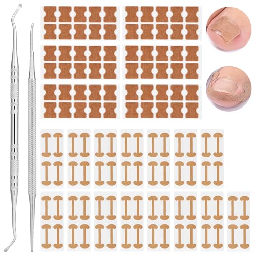 BUTBU Eingewachsene Zehennägel Set, Mit 2 Typen Zehennagel Korrektur Patch, Nagelspange Fußnägel Set, Nagelweicher Fußnägel, Professionell für Paronychie Eingewachsene Fußnägel BUTBU Eingewachsene Zehennägel Set, Mit 2 Typen Zehennagel Korrektur Patch, Nagelspange Fußnägel Set, Nagelweicher Fußnägel, Professionell für Paronychie Eingewachsene Fußnägel von BUTBU