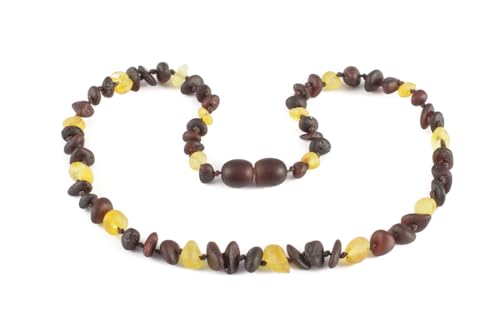Baltische Bernsteinkette für Damen, Herren & Jugendliche – Natürlicher Bernstein Schmuck aus Litauen, Einzigartiges Design, Perfekte Geschenkidee für Mutter, Schwester & Teens (KIRSCHE + HONIG, 37 CM) Baltische Bernsteinkette für Damen, Herren & Jugendliche – Natürlicher Bernstein Schmuck aus Litauen, Einzigartiges Design, Perfekte Geschenkidee für Mutter, Schwester & Teens (KIRSCHE + HONIG, 37 CM) von Baltic Elements