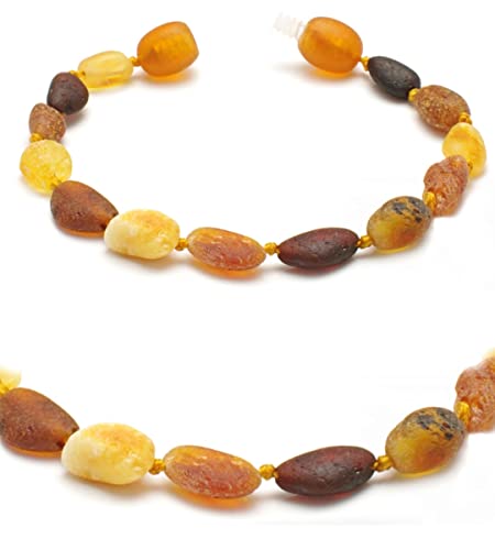 Baltic Secret Selected Baltic Amber Bernsteinarmband für Mädchen und Jungen - Echt Bernstein Schmuck - Natürlicher Heilstein - Glücksbringer - Geschenkidee von Baltic Secret Selected Baltic Amber