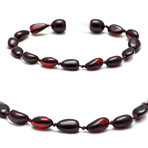 Echtes Bernstein Armband - Ostsee Schmuck - Roh Anti Stress Armband aus Ostsee Echt Stein Perlen - Echter Bernstein Schmuck, beliebt als Glücksstein (KIRSCHE, 20 CM) von Baltic Secret Selected Baltic Amber