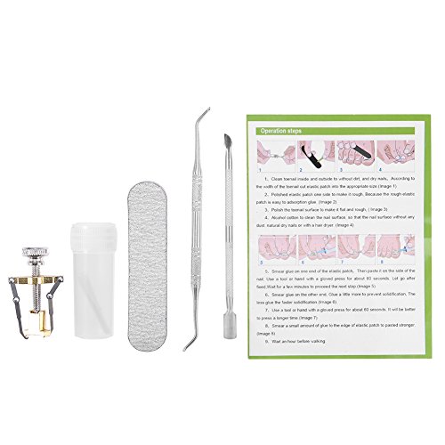 Zehennagel Korrektur Set, Eingewachsene Ingrown Zehennagel Richt Patch, Acronyx Corrector Pedicure Tool von ZJchao