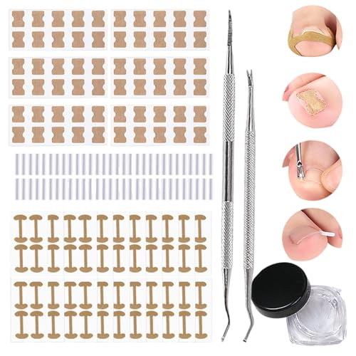 Nagelkorrektur-Patch, Nagelheber-Patches, Zehennagel-Bandage-Streifen, lindert Beschwerden schnell, kompakt und reisefreundlich, 11,5 cm, für Zuhause, Männer, Kinder, Fuß, ältere Menschen, Sportler Nagelkorrektur-Patch, Nagelheber-Patches, Zehennagel-Bandage-Streifen, lindert Beschwerden schnell, kompakt und reisefreundlich, 11,5 cm, für Zuhause, Männer, Kinder, Fuß, ältere Menschen, Sportler von Buhygn