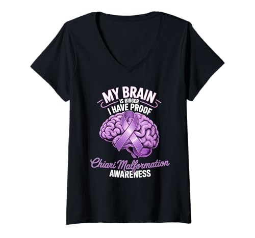Damen Brain Is Bigger Chiari Geschenkband zur Erkennung von Fehlbildungen, Violett T-Shirt mit V-Ausschnitt Damen Brain Is Bigger Chiari Geschenkband zur Erkennung von Fehlbildungen, Violett T-Shirt mit V-Ausschnitt von Chiari Malformation Warrior Survivor Apparel