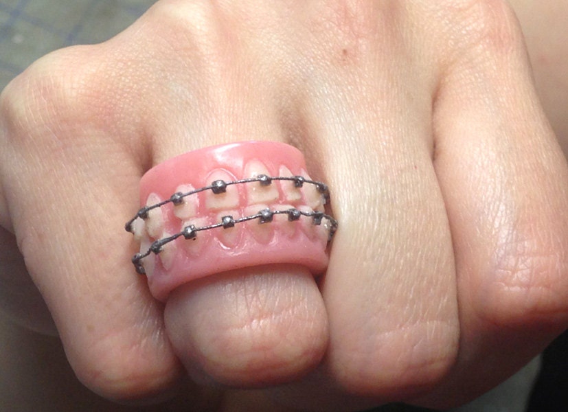 Klammern Ring Klammern Ring von ConcaveOblivion