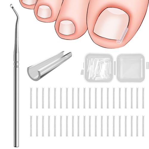 40 Pcs Eingewachsene Zehennägel Set Zehennagel Korrektur Zehennagel Korrektur Patch Nagelspange Fußnägel Eingewachsene Zehennägel Zehennagel Korrektur Mit Lifter Für Eingewachsene Zehennägel von DMNQ