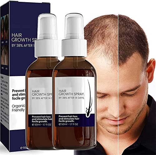 Haarwachstumsformel Serum Spray Anti-Haarausfall Serum zur Reparatur von Haarfollikeln Ginseng Haarwuchs Serum Spray fördert dickeres, kräftigeres Haar für Männer und Frauen von DUBUSH