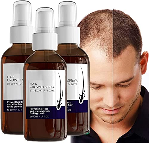 Haarwachstumsformel Serum Spray Anti-Haarausfall Serum zur Reparatur von Haarfollikeln Ginseng Haarwuchs Serum Spray fördert dickeres, kräftigeres Haar für Männer und Frauen von DUBUSH