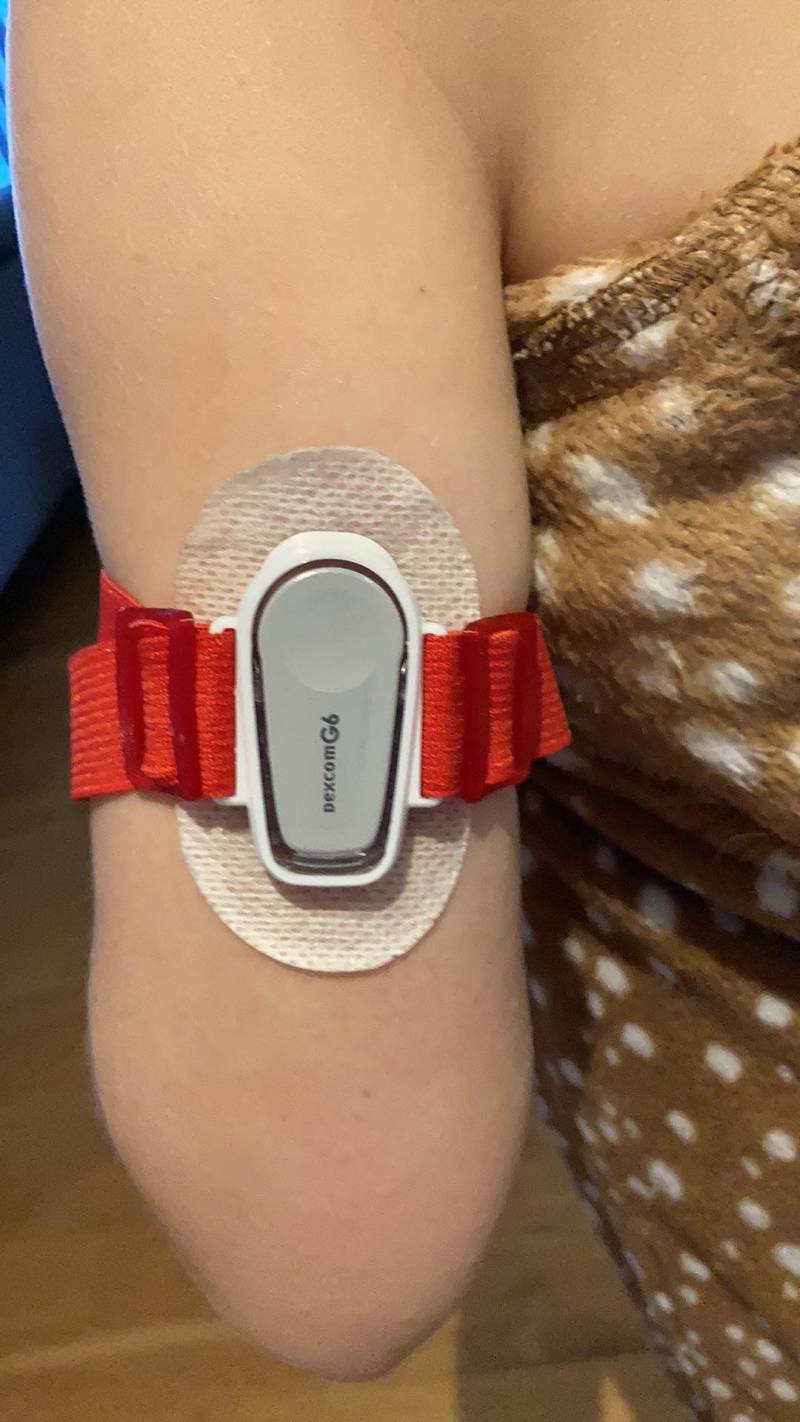 Armband Für Dexcom G6 von DiabeticGuardians