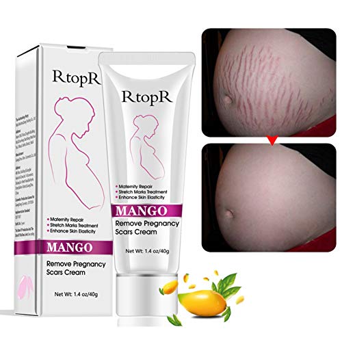 Stretch Marks Cream Narbencreme, Narbencreme Entfernung Creme, Körper Reparatur Creme Dehnungsstreifen Reparatur Körper Haut Moisturzing für Frauen nach Schwangerschaft,40g von Duvina