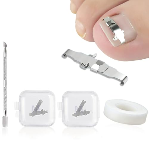 Esshogo 1 Satz Eingewachsene Zehennagel-Werkzeuge, Nagel-Korrekturschnalle, Patch Gebogene Zehennägel Klammer, Premium Edelstahl Maniküre Pediküre, Für Eingewachsene Paronychie-Behandlung von Esshogo
