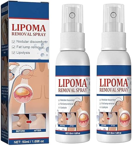 LipoOut Lipomheilung Reduction Spray, Instant Lipoma Removal Spray, Instant LumpFree Lipoma Removal Spray,Anti-cellulite Body Shaper Spray for Men and Women (2 pcs) von Eunmsi