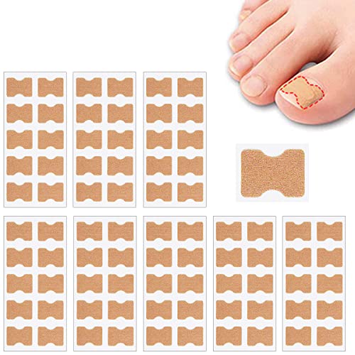 80 PCS Zehennagel Patch, Eingewachsene Zehennägel Korrektur Aufkleber, Zehennägel Korrektur Patch, Korrektor Pediküre Werkzeugen, Pediküre Aufkleber Zehennagel Elastische Patch von Fantasyon