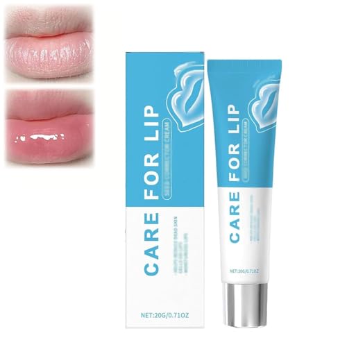 Fordyce Lip Cream,Long-Lasting Moisture Care for Lips,Lip Lightening Cream,Moisturizing Lip Care Balm,Nourishing Formula To Reduce Dryness & Gently Exfoliate Dead Skin (1 Pcs) von Figskey