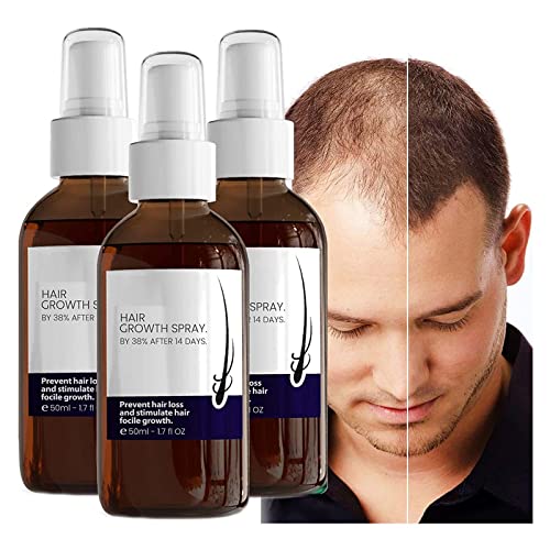 Blusoms Haarwachstums-Formel-Serum-Spray, Blusoms 4500 Haarwachstumsspray, Blusoms-Haarwachstumsserum für trockenes, krauses, geschädigtes Haar für Männer und Frauen (3 Stück) von Fledimo