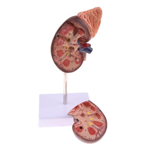 Niere Modell, 24 Markierungen Klare Zonierung Hochwertige Farbbemalung Kein Verblassen Nieren-Anatomie-Modell Flammhemmendes PVC Menschliche Anatomie-Modelle mit Sockel von Fockety