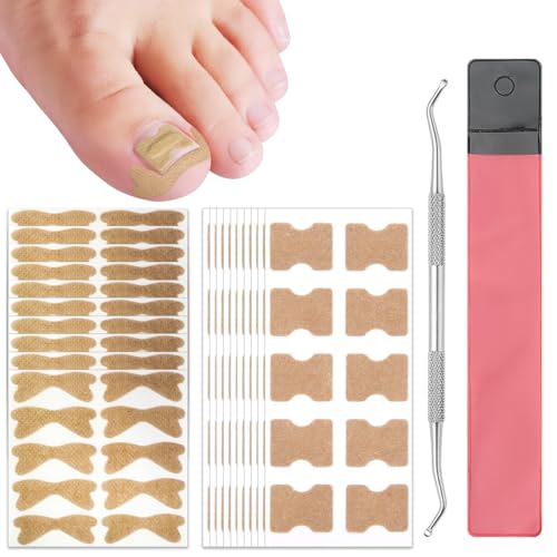 GGUFAY 201 Stück Eingewachsene Zehennägel Set, Zehennagel Korrektur Patch Nagelpflaster Eingewachsen Zehennägel Streifen Nagelpilz Pflaster, mit 1 Pcs Nageleinlagewerkzeug von GGUFAY