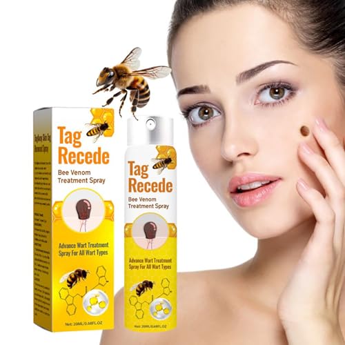 Bienengift 20 ml Bienengift Spray zur Entfernung von Hautflecken, Tag Recede Bienengift Behandlungsspray, für alle Hauttypen (1 Stück) von Generic