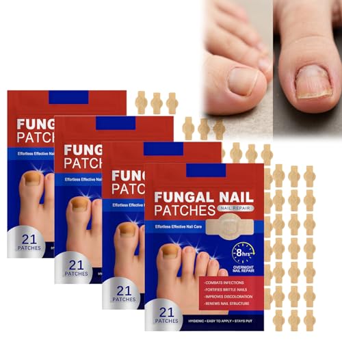 Nagelpflaster, Zehennagel Korrektur Patch, Nagelpflege zur sanften Pflege beanspruchter Nägel, Unterstützt die Erneuerung und Weichheit der Nagelstruktur, 4 * 21pcs von Generic