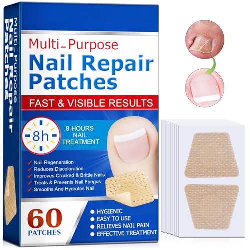 Nāgělpīlz-Pflaster 60 Stück,Zehennagel Korrektur Patch,Pilz-Nagelbehandlungs-Patches,Nagelgraben Reparaturpflaster für Beschädigte Nägel und das Erscheinungsbild Verfärbter Nägel von Generic