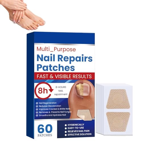 Zehennagel Behandlung - Nāgělpīlz-Pflaster,Zehennagel Korrektur Patch,Stärkende Nägel,für Beschädigte Nägel und das Erscheinungsbild Verfärbter Nägel (A) von Generic
