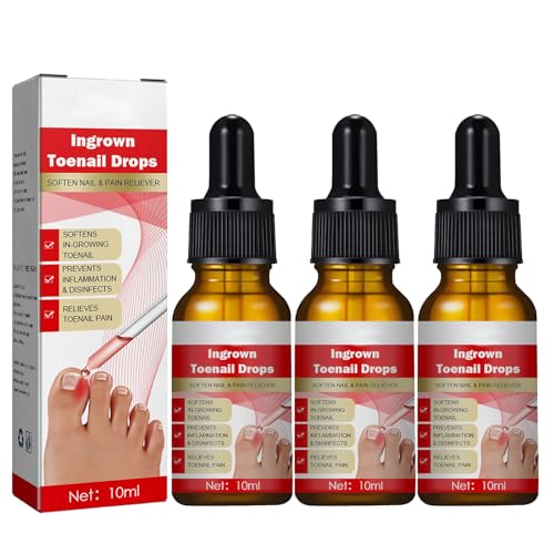 2/3PCS Toenailplus Anti Paronychia Relief Oil Ingrown Toenail Drops Correction Treatment Oil,30ml Eingewachsene Zehennägel - Nagelhautpflege Öle für eingewachsene Zehennägel (3PCS) von Generisch