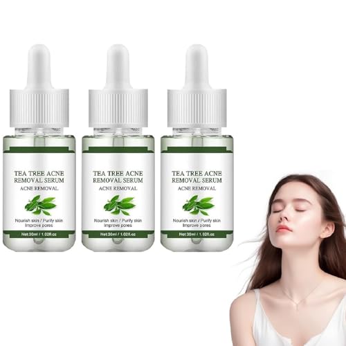 Akne-entfernendes Gesichtsserum, Natürliche Feuchtigkeitsspendende Aknebehandlung, Aufhellende Gesichtscreme, Ölkontrolle, Feuchtigkeitscreme & Feine Poren Für Frauen & Männer (3pcs) von Generisch