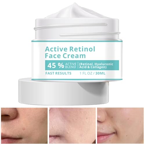 Feuchtigkeitscreme für das Gesicht Frauen, Feuchtigkeitscreme für das Gesicht - Natürliche feuchtigkeitsspendende Gesichtscreme - 30 ml feuchtigkeitsspendende Feuchtigkeitscreme, beruhigend für strahl von Generisch