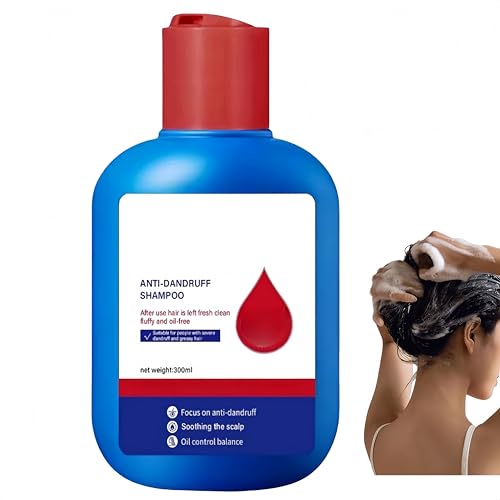 Oil Control Erfrischendes Anti-Schuppen-Reinigungsshampoo, Tiefenreinigung, langanhaltende Feuchtigkeitspflege, beruhigt die Kopfhaut für Männer und Frauen Oil Control Erfrischendes Anti-Schuppen-Reinigungsshampoo, Tiefenreinigung, langanhaltende Feuchtigkeitspflege, beruhigt die Kopfhaut für Männer und Frauen von Generisch