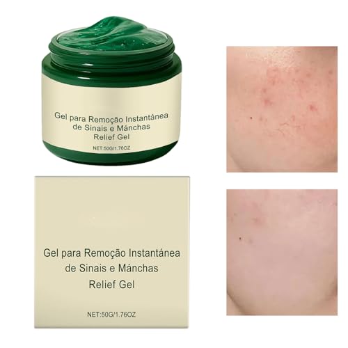 Sommersprossen Entferner Für Gesicht,50g Körpercreme Bei Unreiner Haut | Fleckencorrector Mit Nachtpflege Für Frauen Sommersprossen Entferner Für Gesicht,50g Körpercreme Bei Unreiner Haut | Fleckencorrector Mit Nachtpflege Für Frauen von Generisch