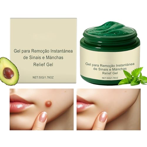 Sommersprossen Entferner Für Gesicht - 50g Körpercreme Bei Unreiner Haut,Fleckencorrector Mit Nachtpflege Für Frauen Sommersprossen Entferner Für Gesicht - 50g Körpercreme Bei Unreiner Haut,Fleckencorrector Mit Nachtpflege Für Frauen von Generisch