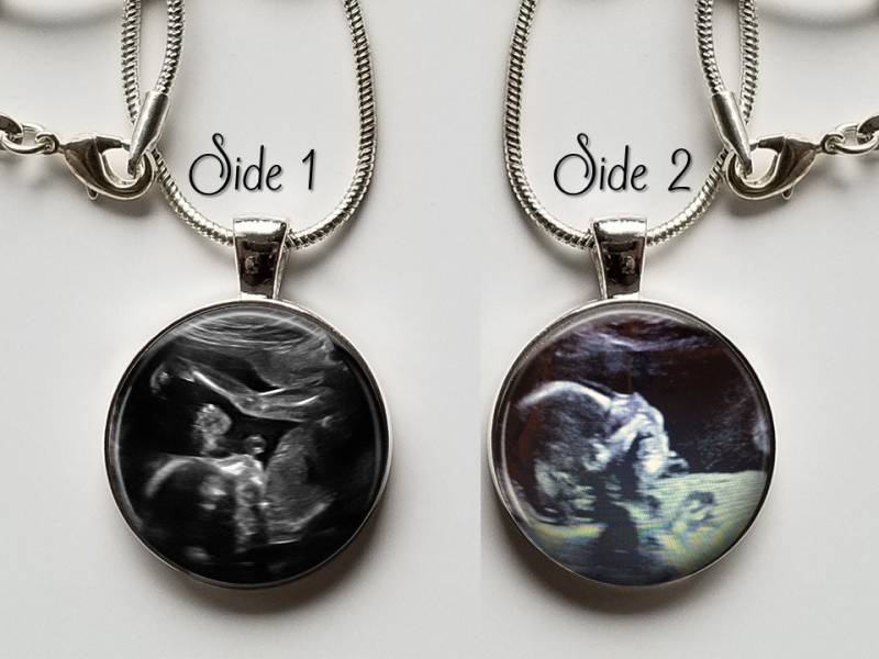 Ultraschall Doppelseitige Halskette - 2 Seitiger Sonogramm Anhänger von GirlPowerPendants