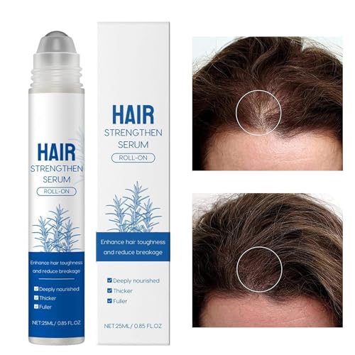 GkgWuxf Haarwuchs Stift | Haarpflege Bei Haarausfall,25ML Nährstoffreiche Nicht Fettende Kopfhautpflege Roller Lösung Für Dünner Werdendes Haar Beauty Reise Salon Frauen Männer Freund von GkgWuxf