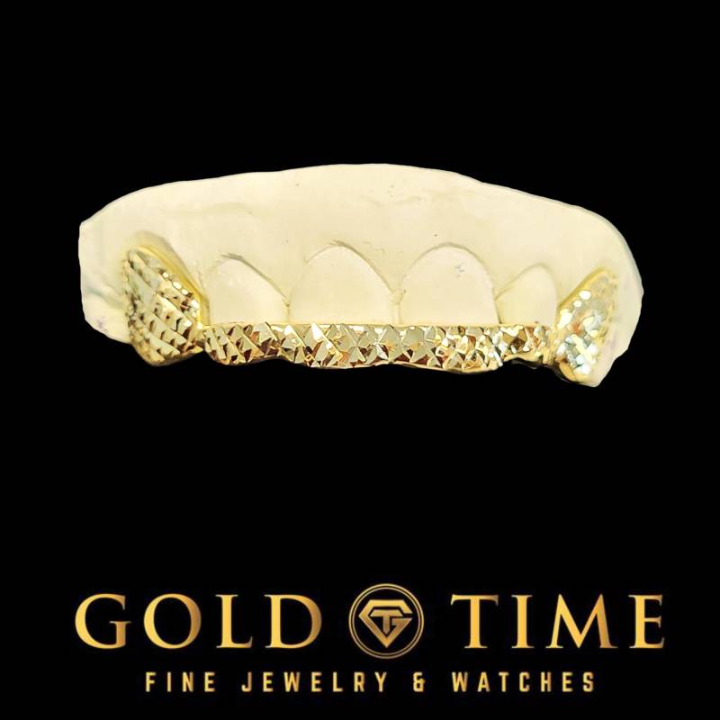 Custom 6 Piece Trillion Cut Grillz 10K/14K Gold, Front Tips Custom 6 Piece Trillion Cut Grillz 10K/14K Gold, Front Tips von GoldTimeKilleen