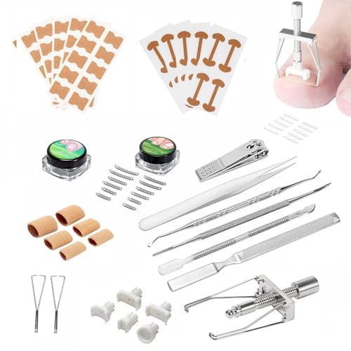 Eingewachsene Zehennägel Set, Nagelkorrekturspange Zehennagel Korrektur Set Eingewachsene Zehennagel Korrektur Zehennagelkorrektur Patch für Paronychie Eingewachsene Fußnägel Schützt Zehennägel von Hyxodjy