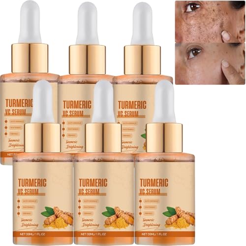 Kurkuma Vitamin C Gesichtsserum mit Hyaluronsäure, Dark Spot Correcting Glow Serum, Aufhellung eines gleichmäßigen Hauttons, Hydratation Anti-Aging, Day Night Gesichtsserum für Frauen (6Stück) von JASUBAI