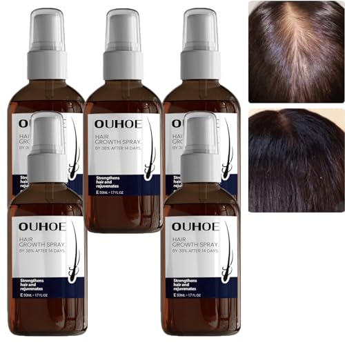 OUHOE Hair Growth Spray for Men & Women, Ouhoe Hair Growth Oil, Ouhoe Hair Enhance Serum, Ouhoe Stronger And Hair Thickening Spray, Hair Regrowth Treatments for Dry, Hair Regrowth (5PCS) von JASUBAI