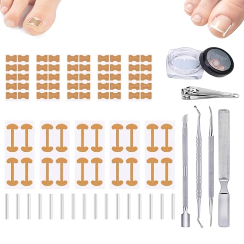 Professionelles Nagelpflege-Set mit atmungsaktiven Streifen für eingewachsene Zehennägel, einem Patch zur Korrektur gebogener Zehennägel, einer schmerzfreien Feile und Pediküre-Werkzeugen von JIOFUGH