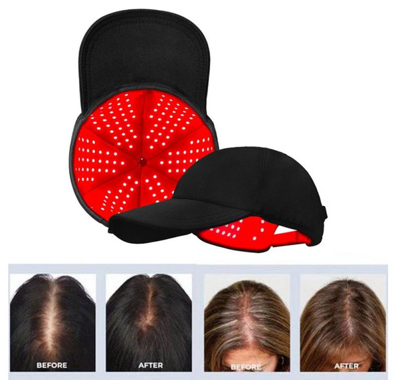 JOYOLEDER Infrarotlampe Rotlichttherapie-Kappe - Nahinfrarotlicht-Haarwachstumsgerät, 180 LEDs, 660nm, 850 und 940nm Wellenlängen, Haarausfallbehandlung bei dünner werdendem Haar von JOYOLEDER