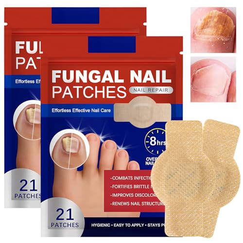 42 StüCk Nagelpflaster, Mehrzweck Zehennagel Pads, Pflaster Zehennagel, Zehennagel Korrektur Patch, für Beschädigte Nägel und Erscheinungsbild Verfärbter Nägel, für Männer und Frauen 42 StüCk Nagelpflaster, Mehrzweck Zehennagel Pads, Pflaster Zehennagel, Zehennagel Korrektur Patch, für Beschädigte Nägel und Erscheinungsbild Verfärbter Nägel, für Männer und Frauen von Jadyon