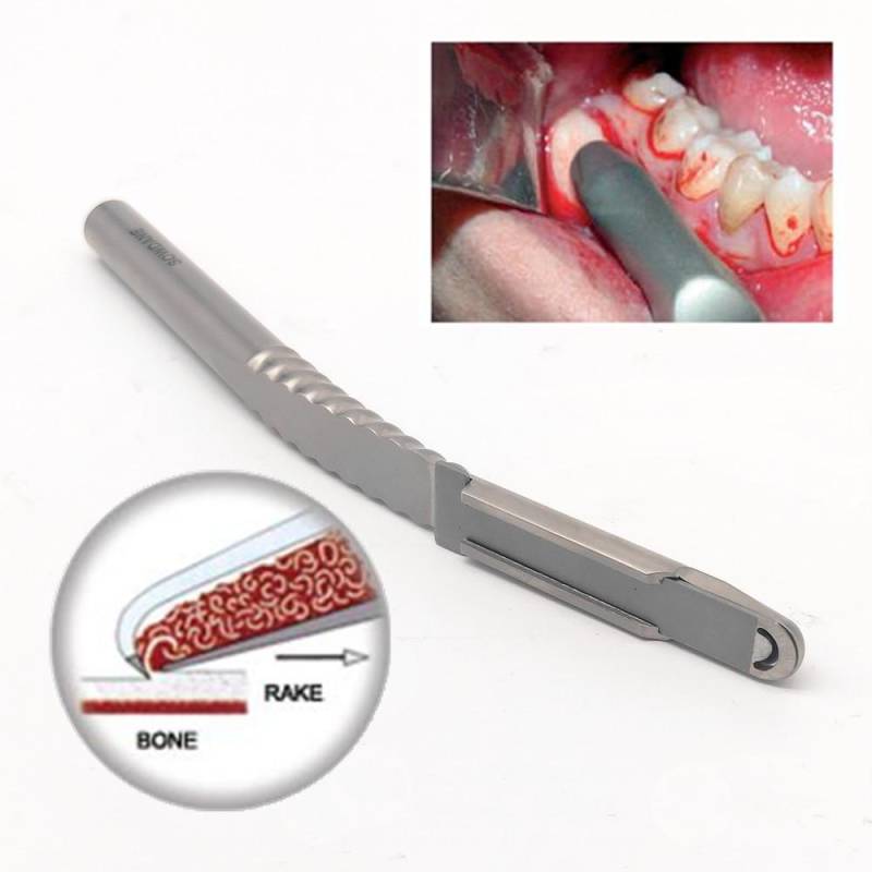 Dental Knochen Schaber Dental Ochsenbein Meißel Doppel Enden Zahn Knochen Messer Split Pfropfen Oral Chirurgie Werkzeug Edelstahl Zahnarzt Werkzeuge 1 piece bone scraper von Joom DACH