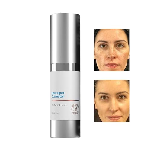 Pigmentflecken Korrekturcreme Für Das Gesicht, Gesichtsserum, Dunkle Flecken Korrektur Und Falten Reduzierendes Pflegeserum, Aufhellend Und Nährend, Alle Hauttypen Frauen & Männer Pigmentflecken Korrekturcreme Für Das Gesicht, Gesichtsserum, Dunkle Flecken Korrektur Und Falten Reduzierendes Pflegeserum, Aufhellend Und Nährend, Alle Hauttypen Frauen & Männer von Jukeoiu