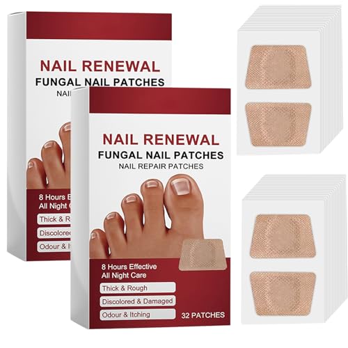 Nagelpilzpflaster - Nail Patches,Pilz-Nagelbehandlungs-Patches, Nagel Reparatur Pflaster, Zehenpflaster, Fußnägel Patch, Zehennagel Korrektur Patch, Nagelpflegeprodukte (2) von Junjie