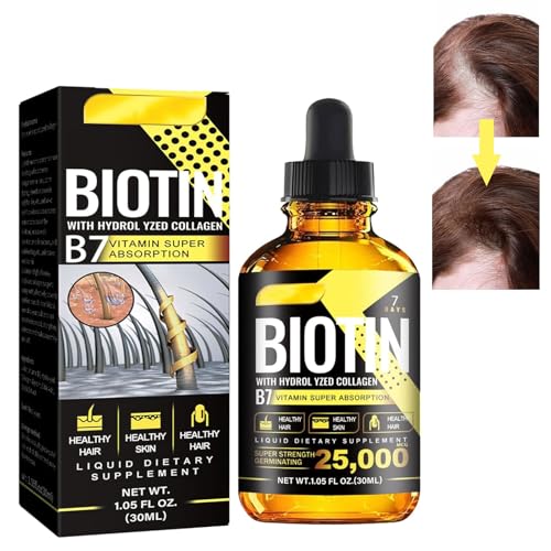 Haarwachstum Serum,Haarwachstum, Anti Haarausfall,30ml Hair Growth Serum,Haarwuchsmittel für Frauen und Männer,für Dünner Werdendes Haar, Verdickung und Nachwachen,für Schnelles Haarwachstum von KARELLS
