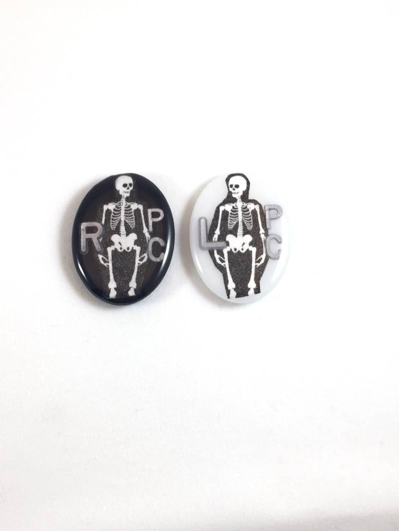 Skelett-Röntgenmarker, Radiologie Marker Mit Initialen Skelett-Röntgenmarker, Radiologie Marker Mit Initialen von KBXRAYMARKERS